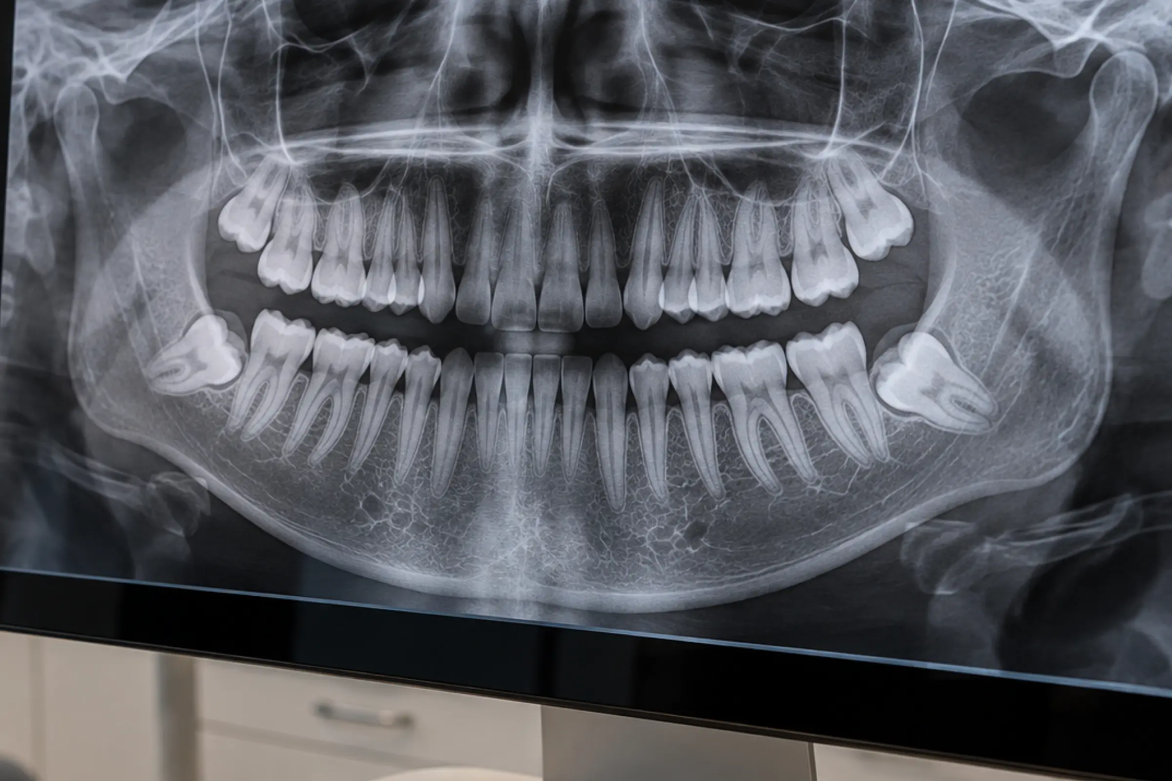 Cirurgias odontológicas